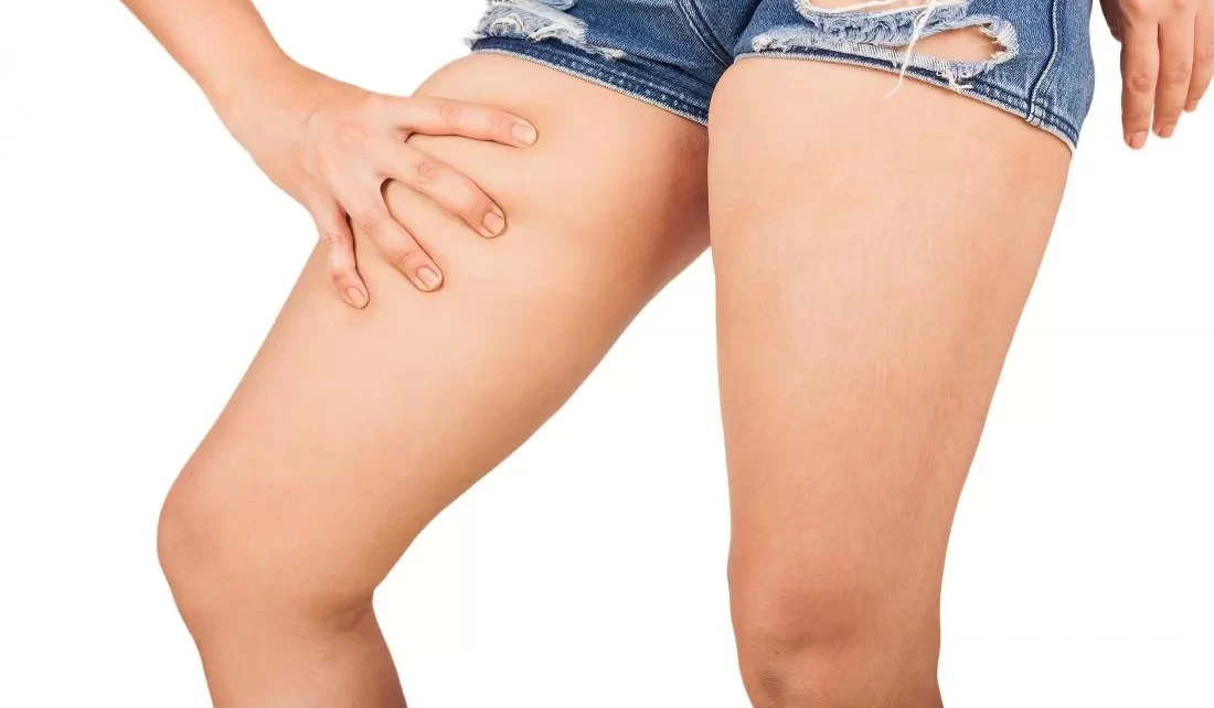 Chafing