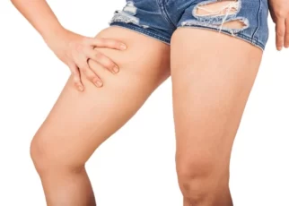Chafing